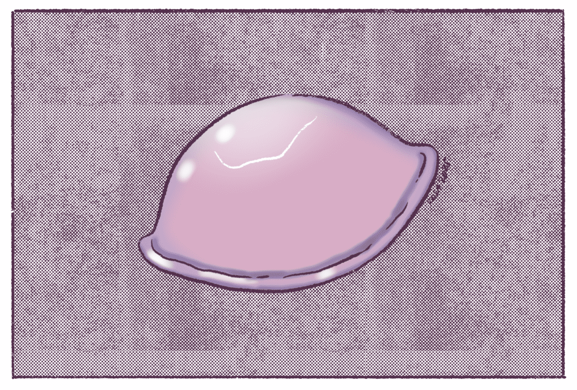 Hablemos de anticonceptivos: diafragma